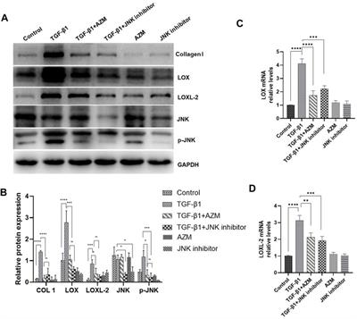 Azithromycin Attenuates Bleomycin-Induced Pulmonary Fibrosis Partly by Inhibiting the Expression of LOX and LOXL-2